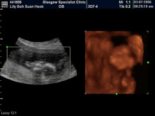 Vivian Sonograms